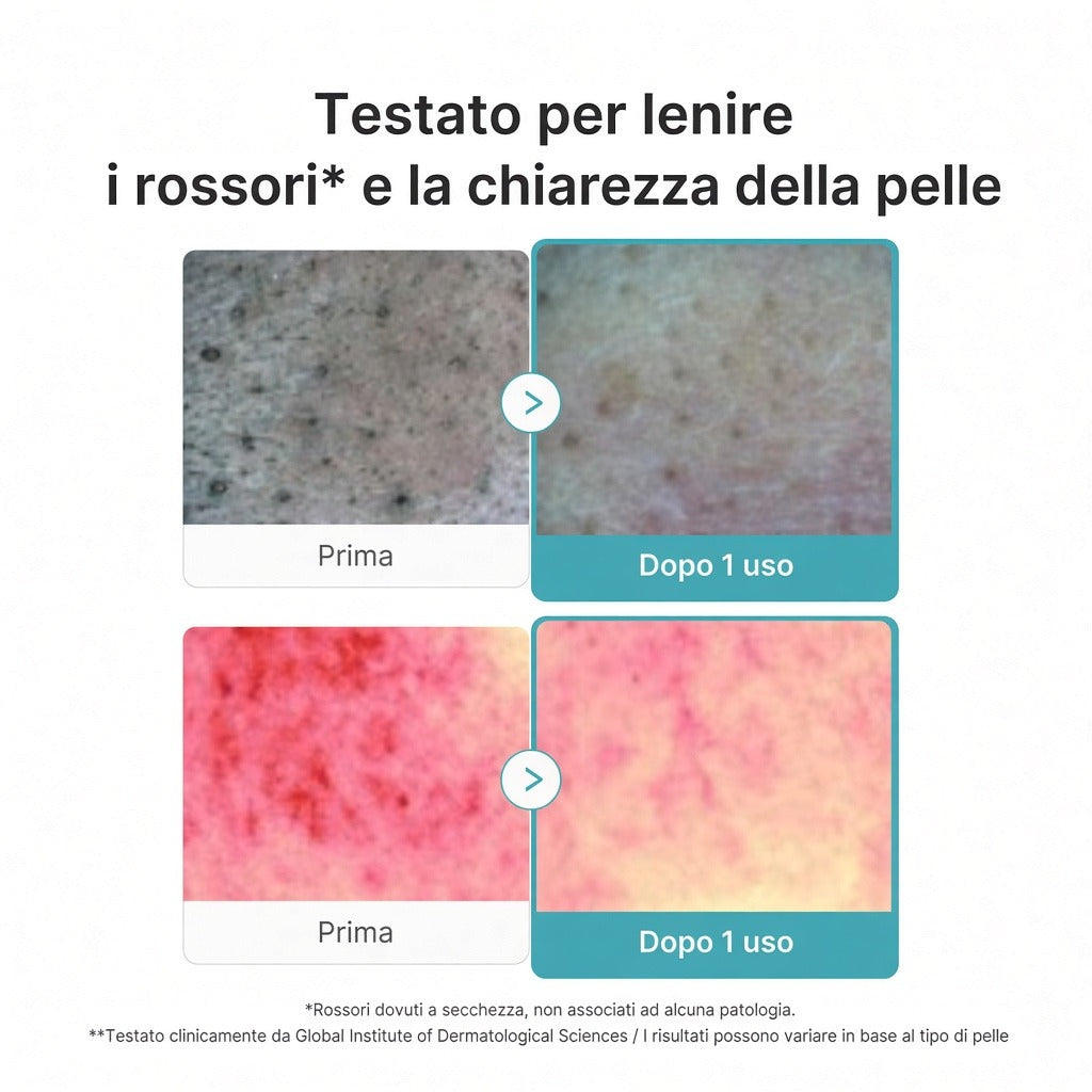 Schiuma detergente in capsule all'Acido Azelaico