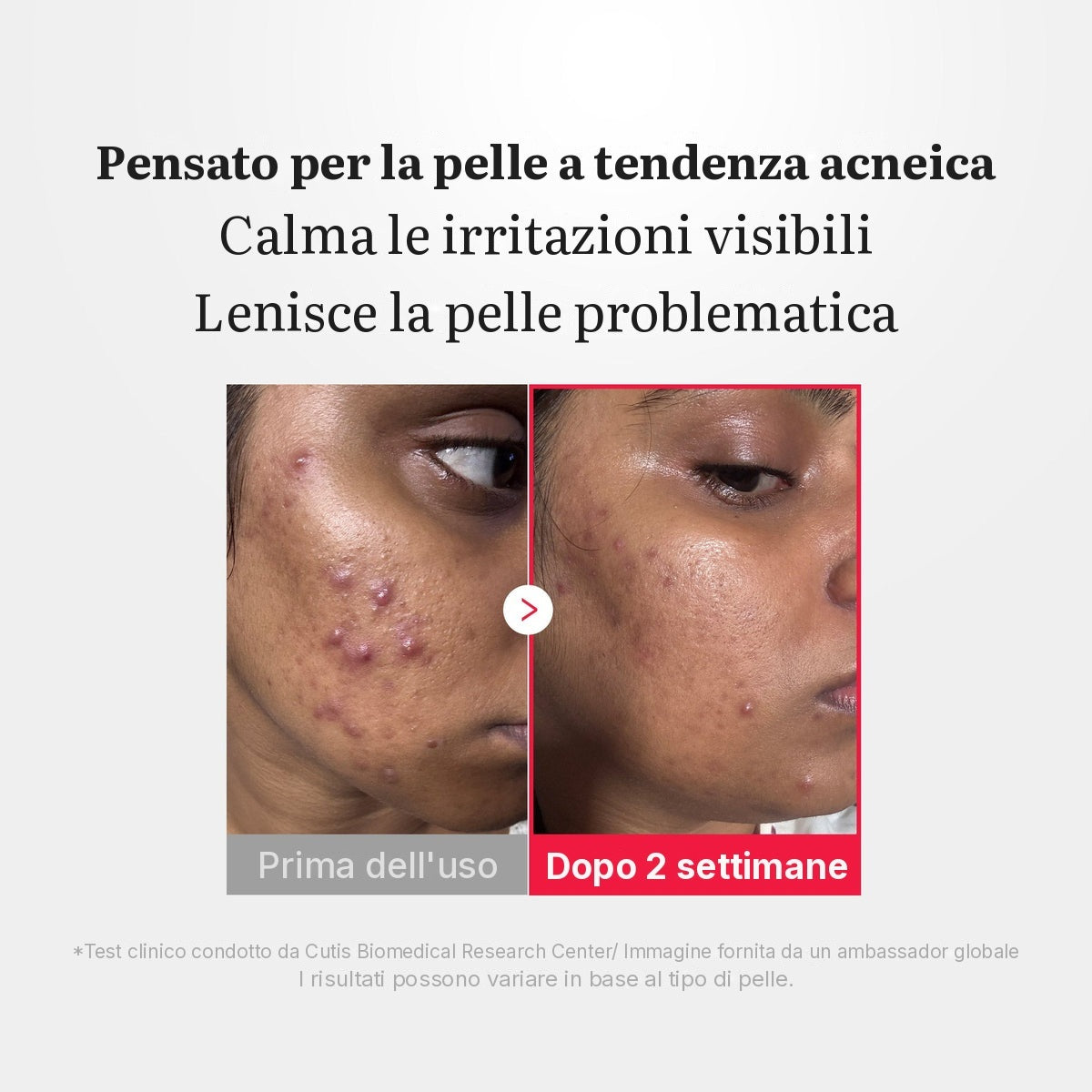 Spray lenitivo Power all'Acido Ipocloroso