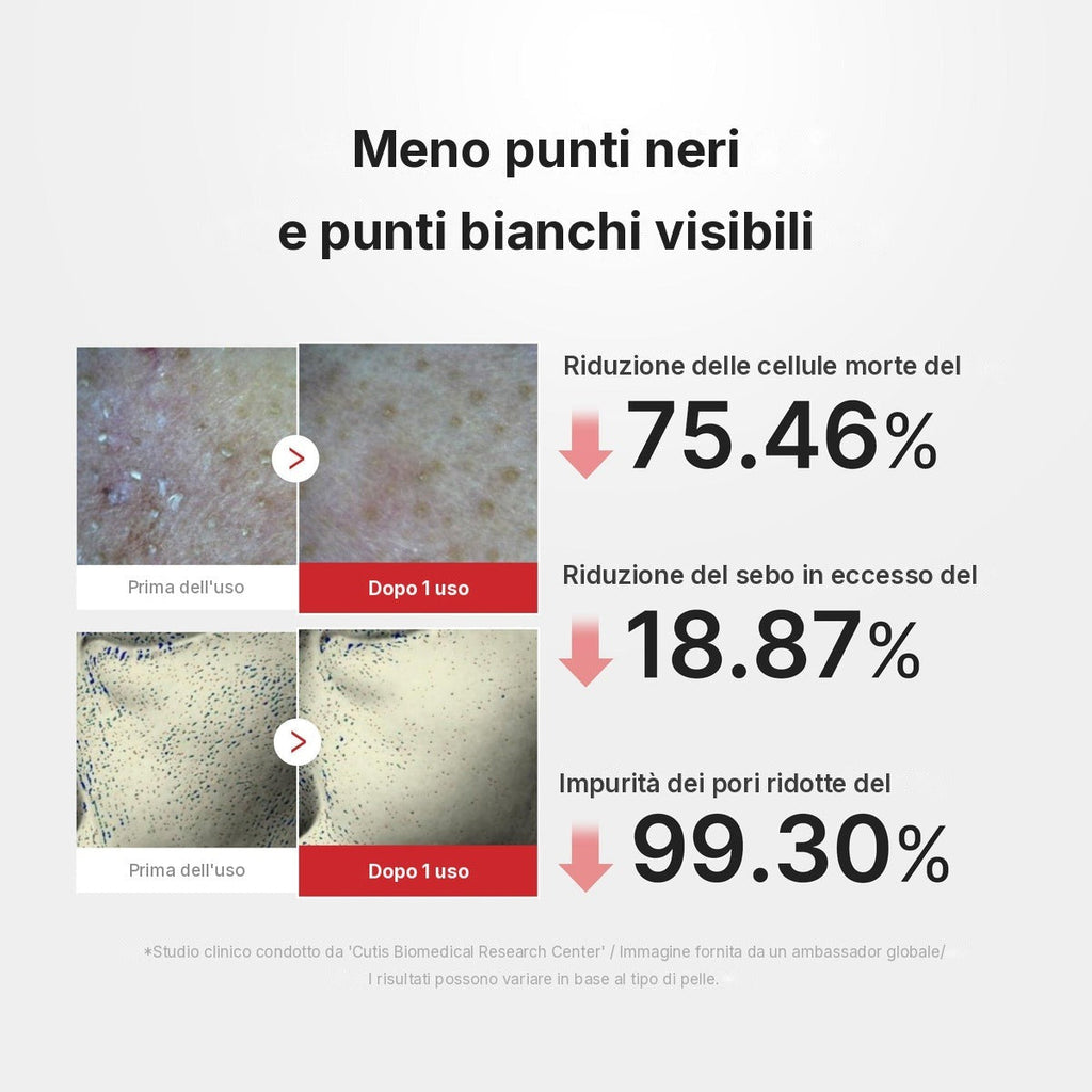 Peel Shot al Riso e Acido Ipocloroso
