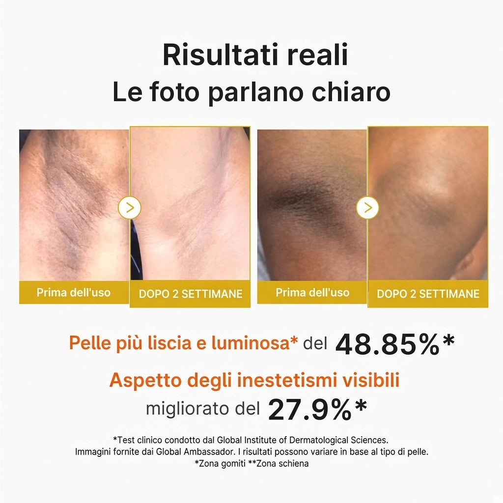 Body Peel Shot Acido Cogico e Curcuma