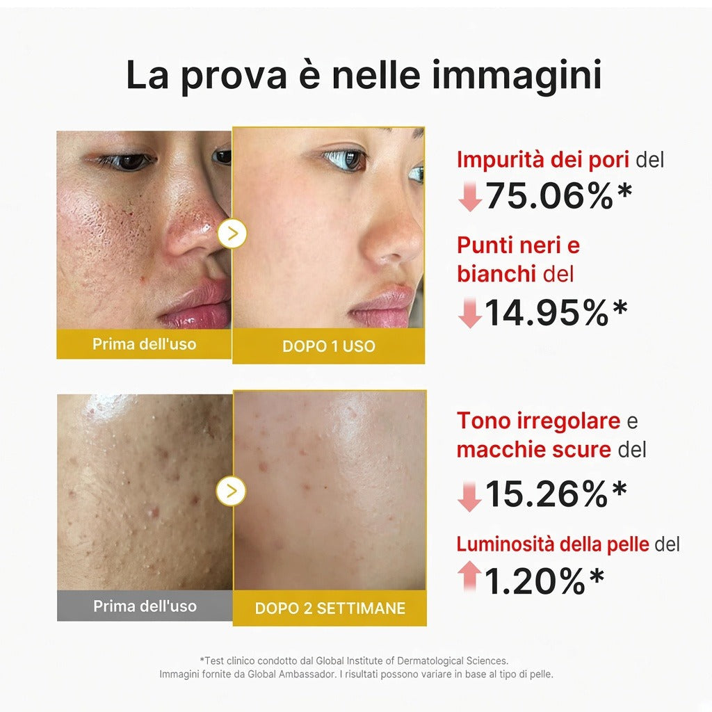 Peel Shot Acido Cogico e Curcuma