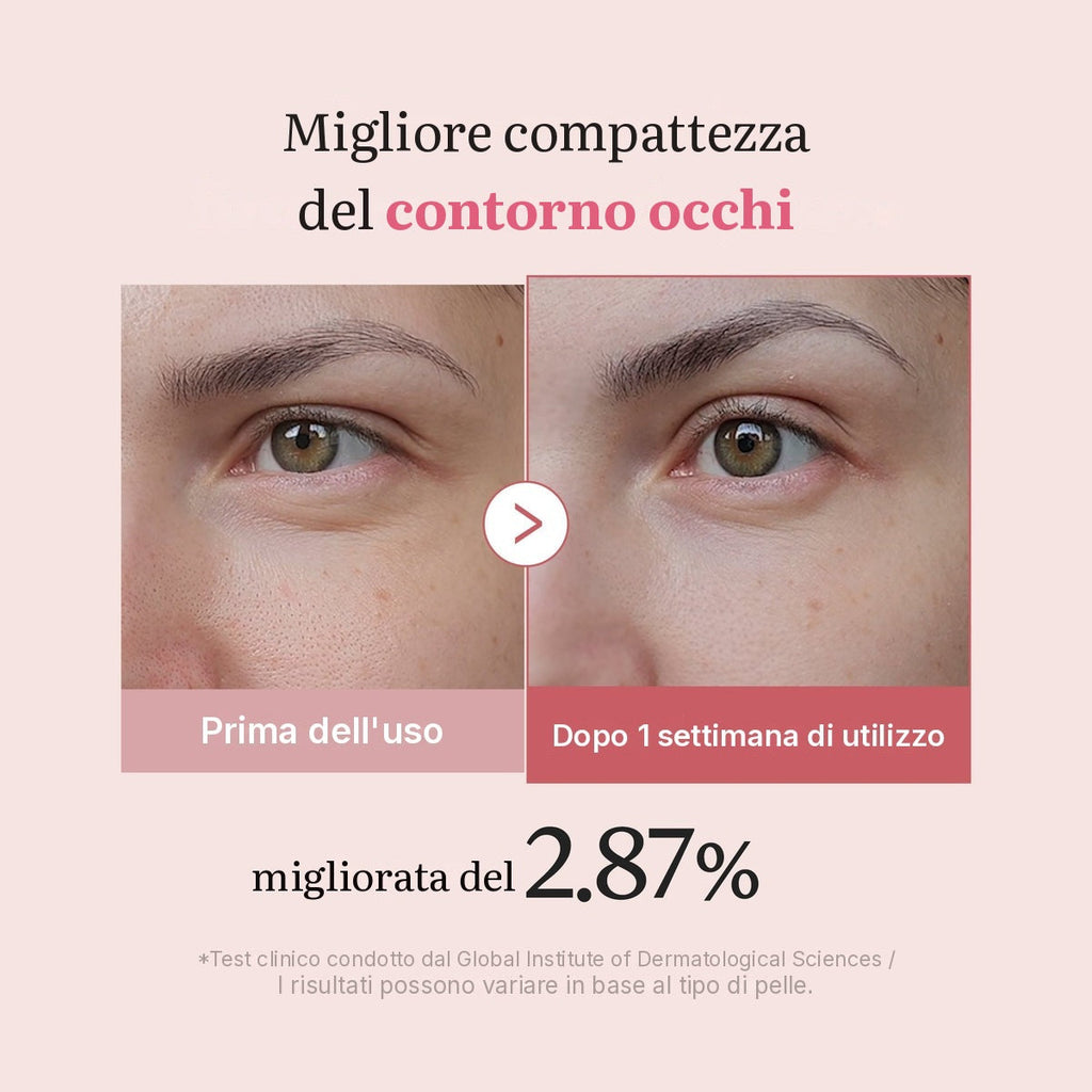 Crema contorno occhi PDRN Pink ai Peptidi