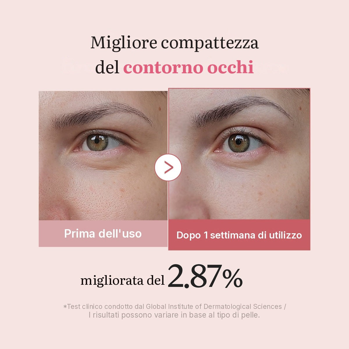 Crema contorno occhi PDRN Pink ai Peptidi