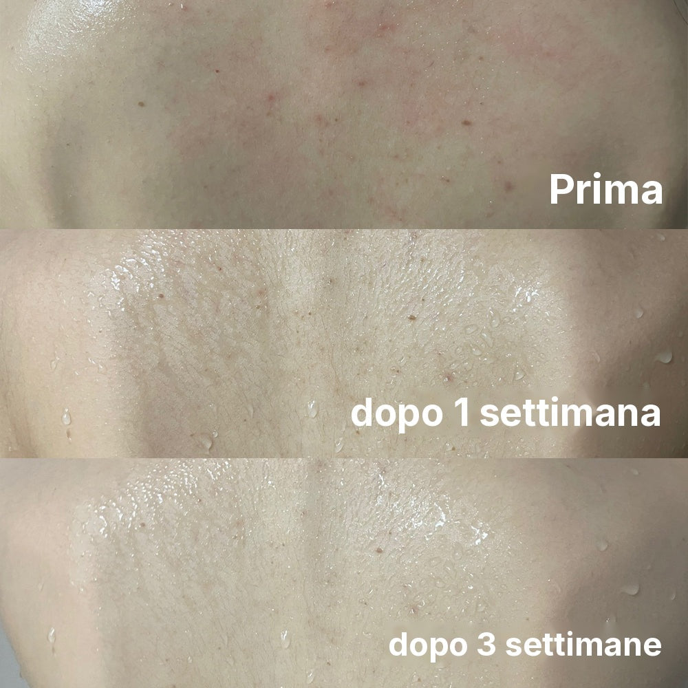Bagnoschiuma Red