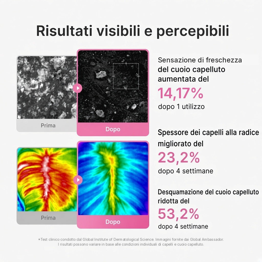 Siero per cuoio capelluto Rosmarino PDRN