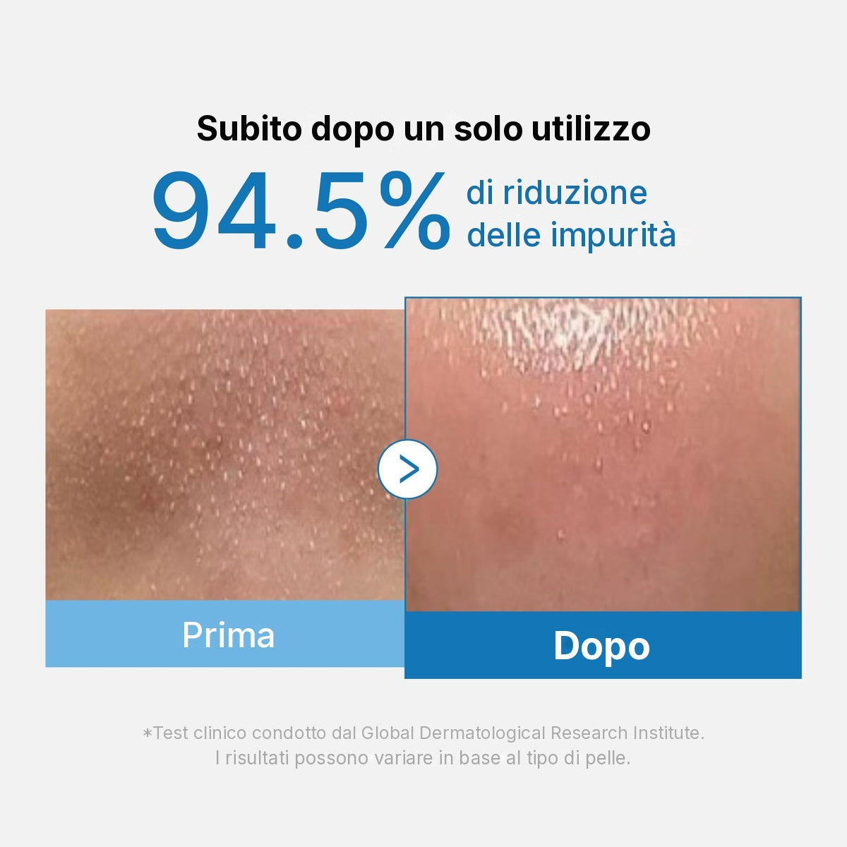 Olio detergente profondo anti-punti neri Zero Pore