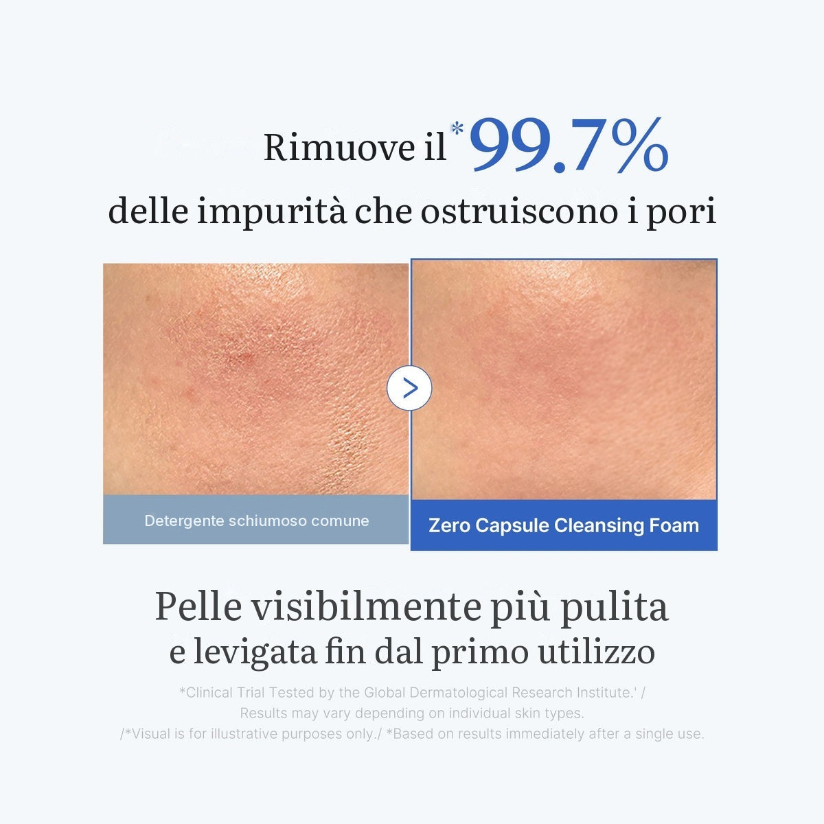 Schiuma detergente in capsule Zero Pore