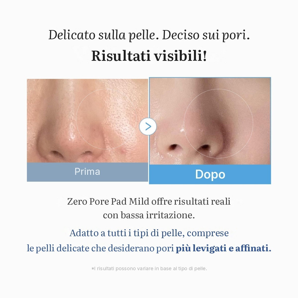 Dischetti Zero Pore Madecassoside (delicati)